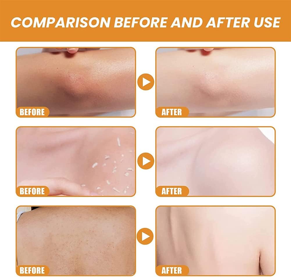 Orange Zyme Deep Clean Gel – Soft & Bright Skin Solution