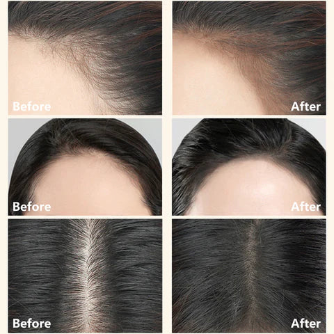 2 In 1 Perfect Hairline & Eyebrow Shaping Stamp